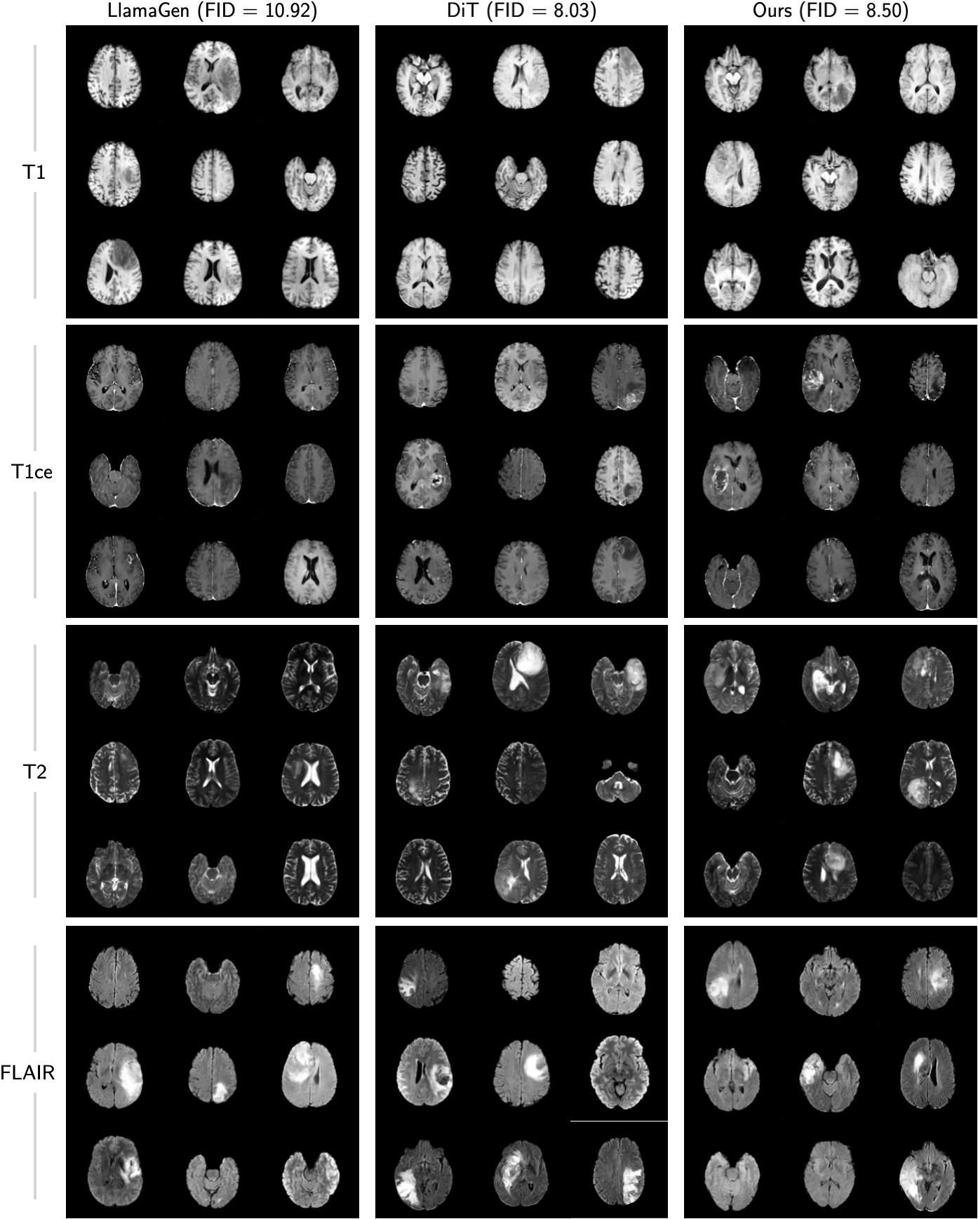 Modality-conditioned brain MRI generation
