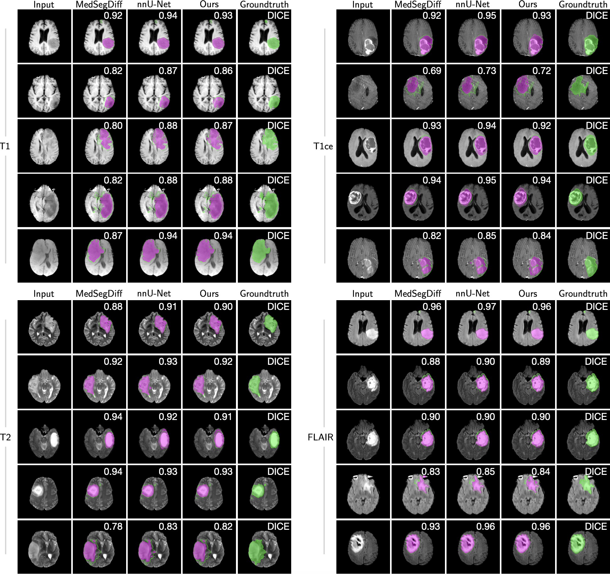 Brain tumor segmentation across modalities