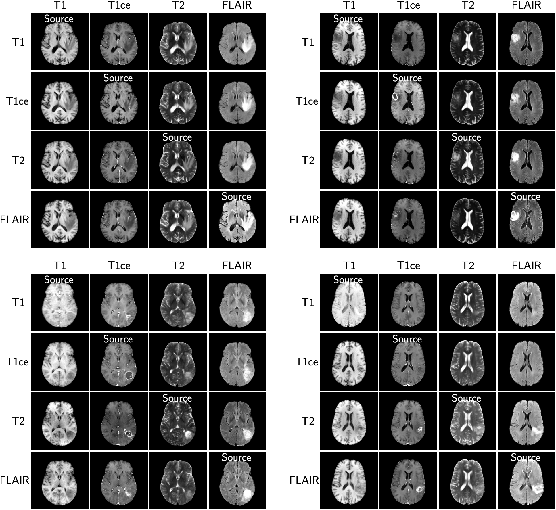 Any-to-any cross-modal MRI translation
